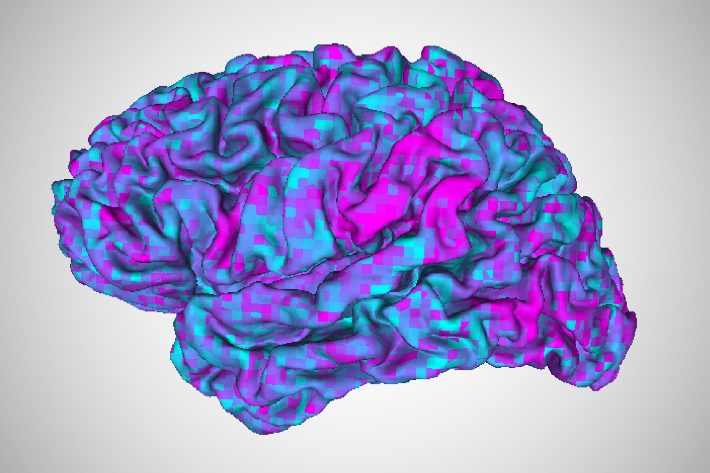 Revolutionary Brain Decoder Offers New Hope for Enhancing Communication in Individuals with Aphasia