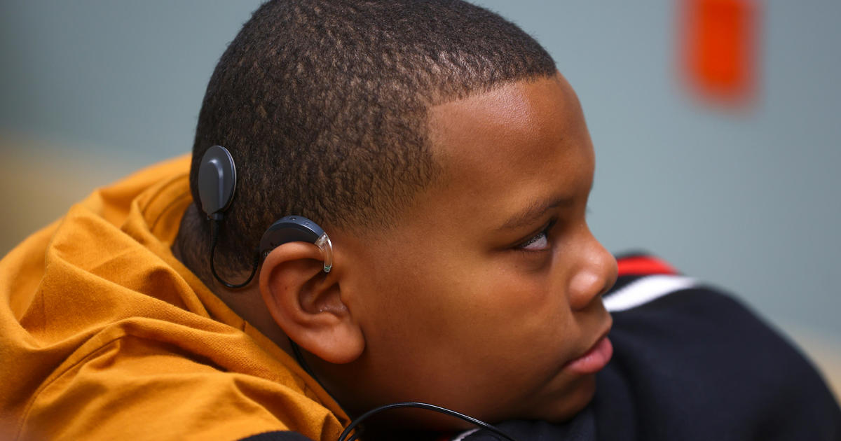 UK HealthCare pediatric patient 1st in US to receive new cochlear implant technology