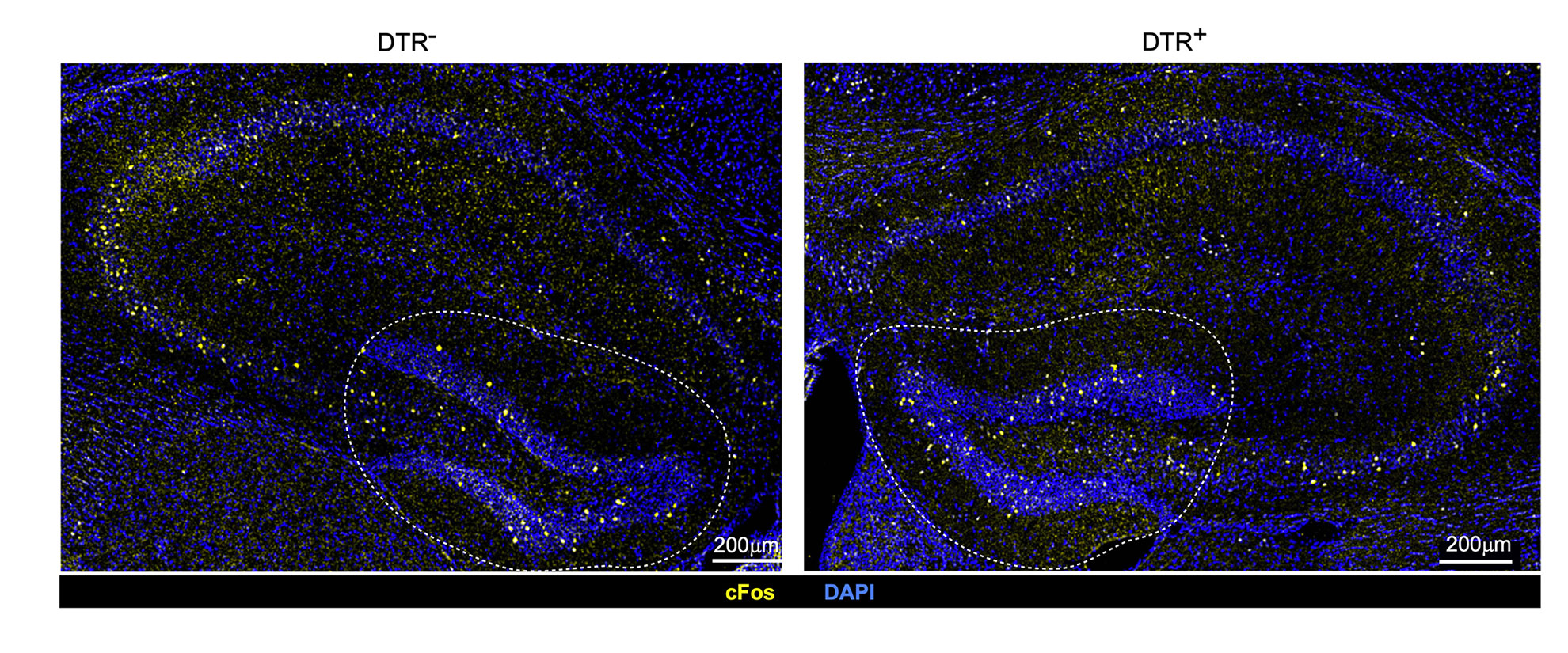 Variances in neuronal stimulation in mice with intact Tregs (left) and depleted Tregs (right). 