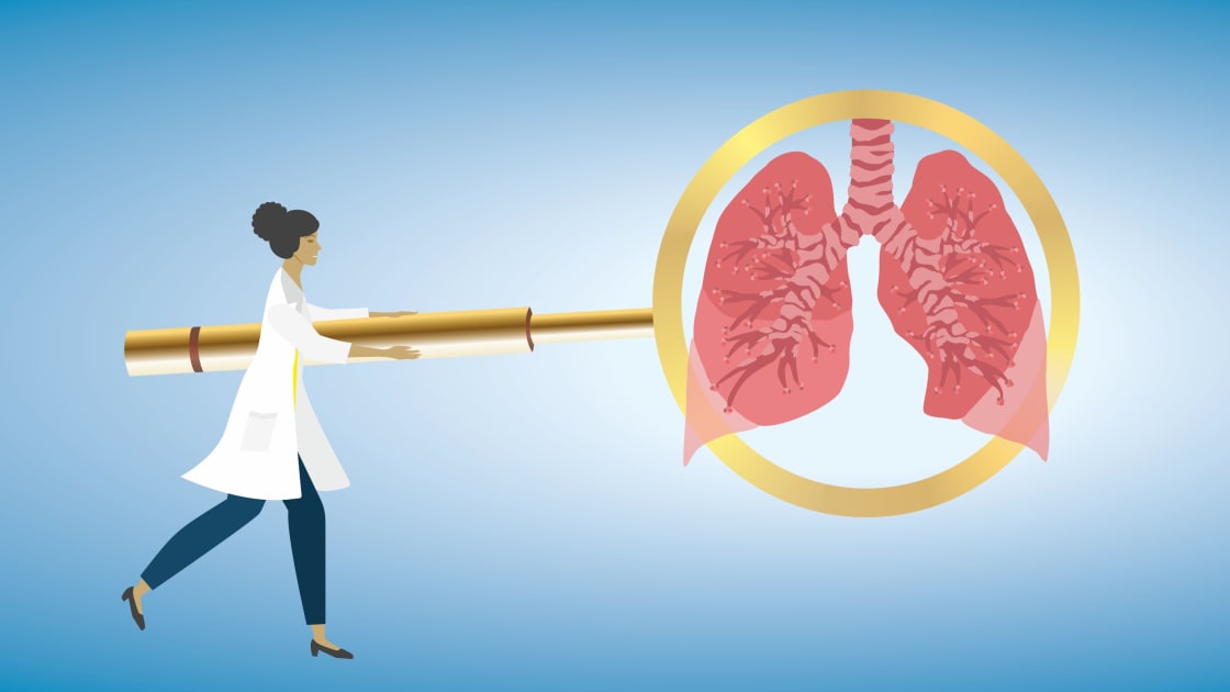 Fresh Insights into the Connection Between Smoking and Cancer