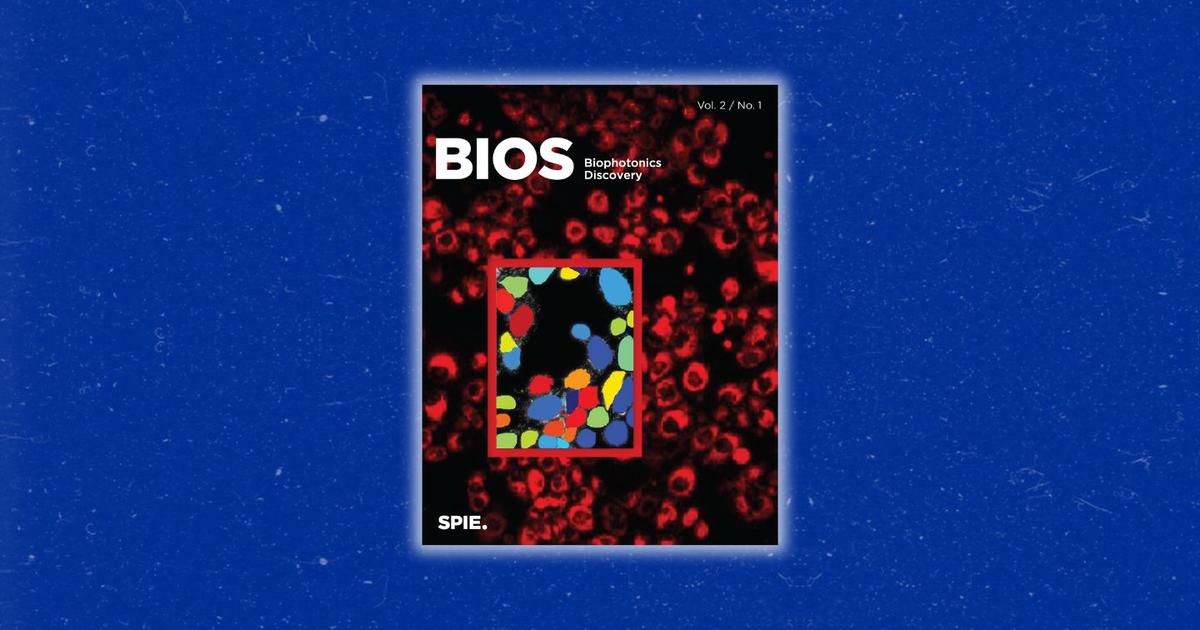 UK researchers develop groundbreaking microscopy technique to study cancer