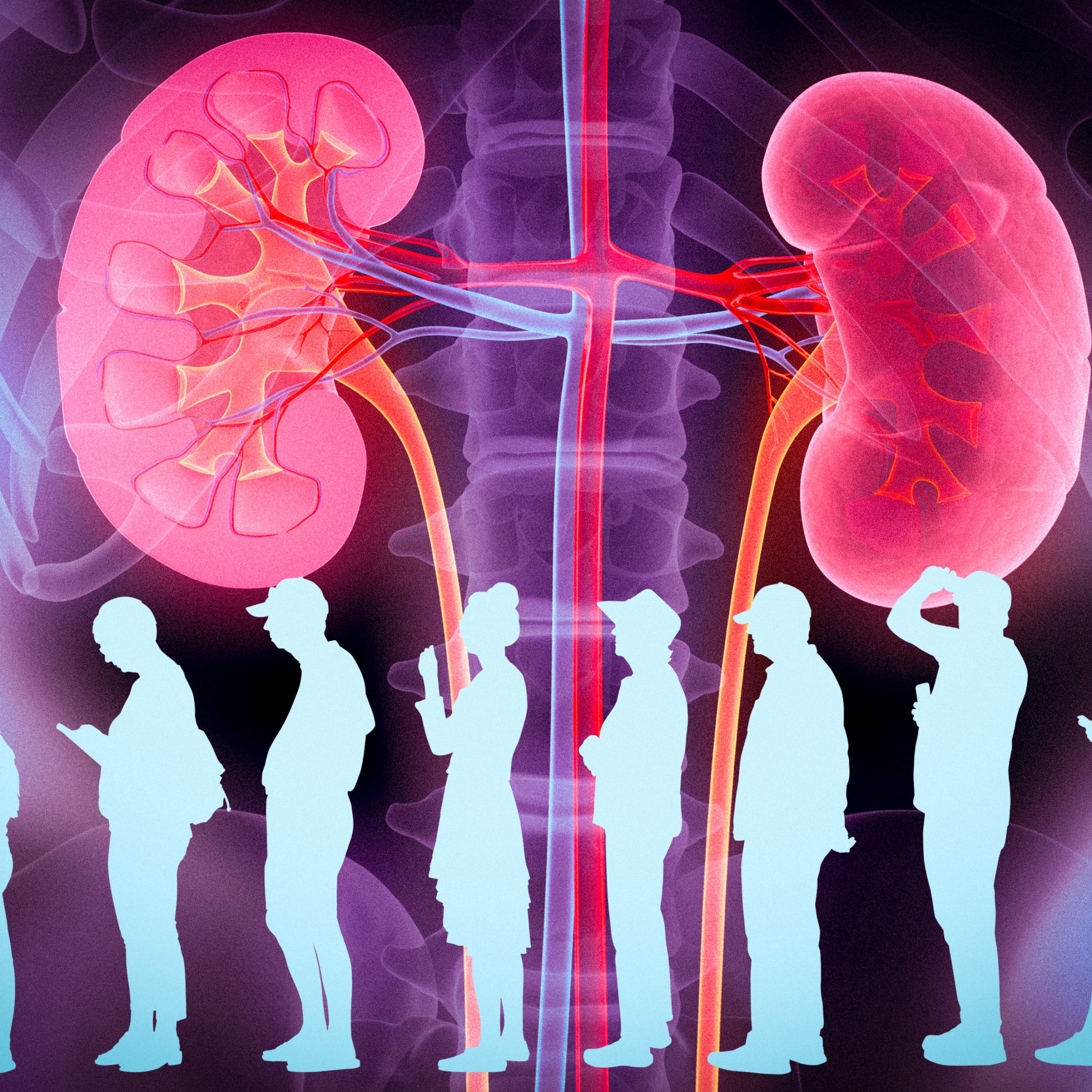 Revolutionizing the Kidney Transplant Waiting List: A New Approach to Patient Prioritization