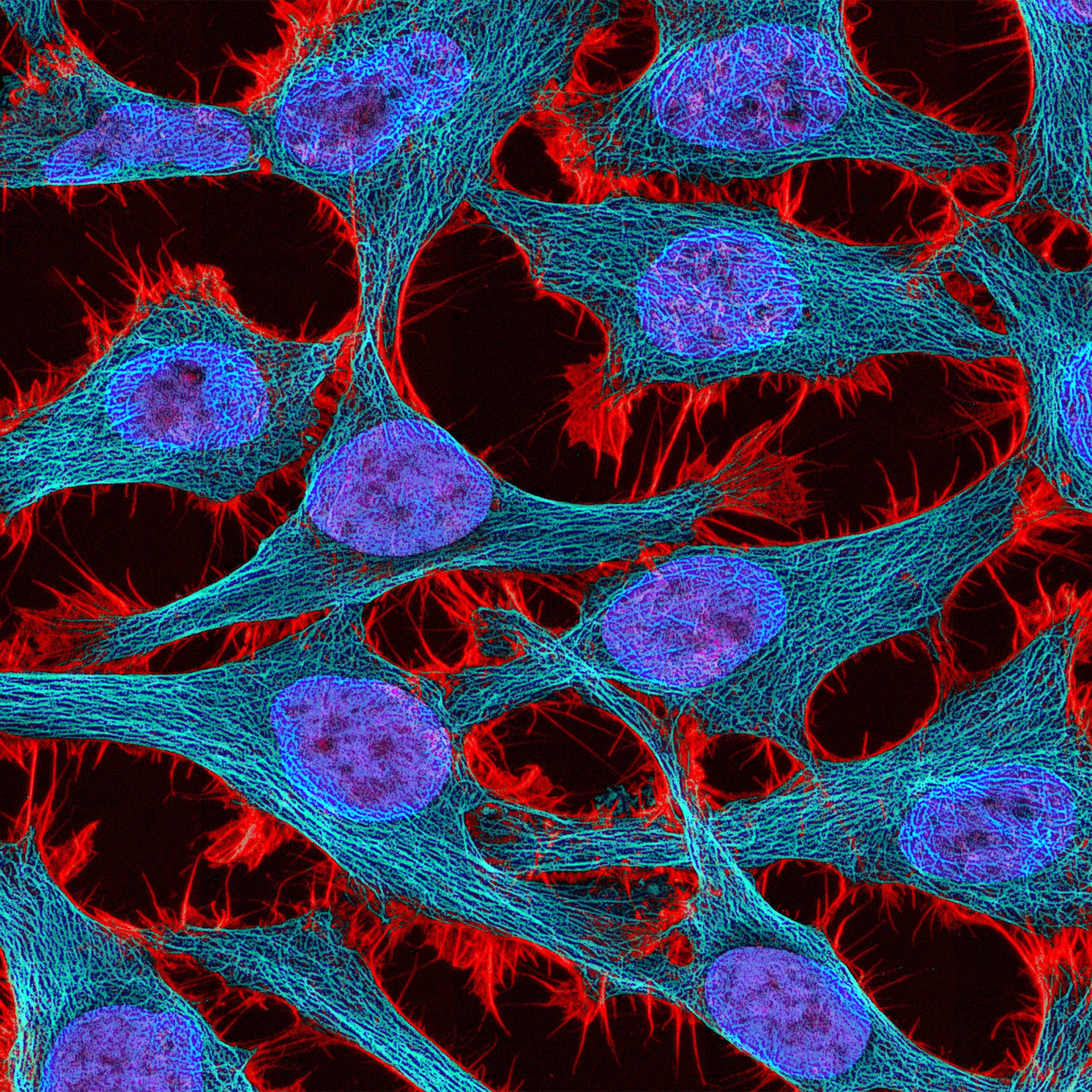 Precision Control in Gene Therapy: Unlocking the Potential of Gene Circuits