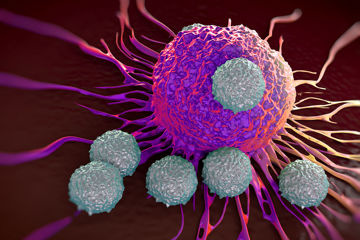 Immunotherapy Breaks New Ground in Enhancing Survival Rates for Locally Advanced Head and Neck Cancer Patients