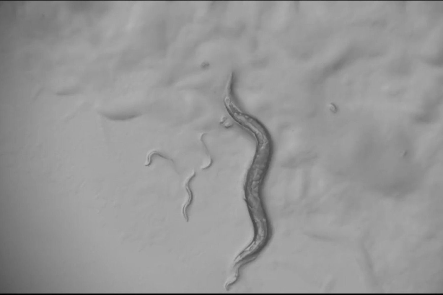 “Unlocking the Nervous System: How Infection Reveals Its Unexpected Flexibility”