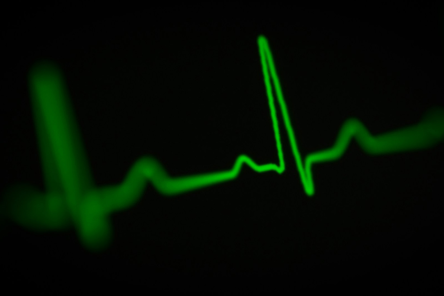 Revolutionizing Health Monitoring: How AI-Driven Radar Technology Takes Center Stage
