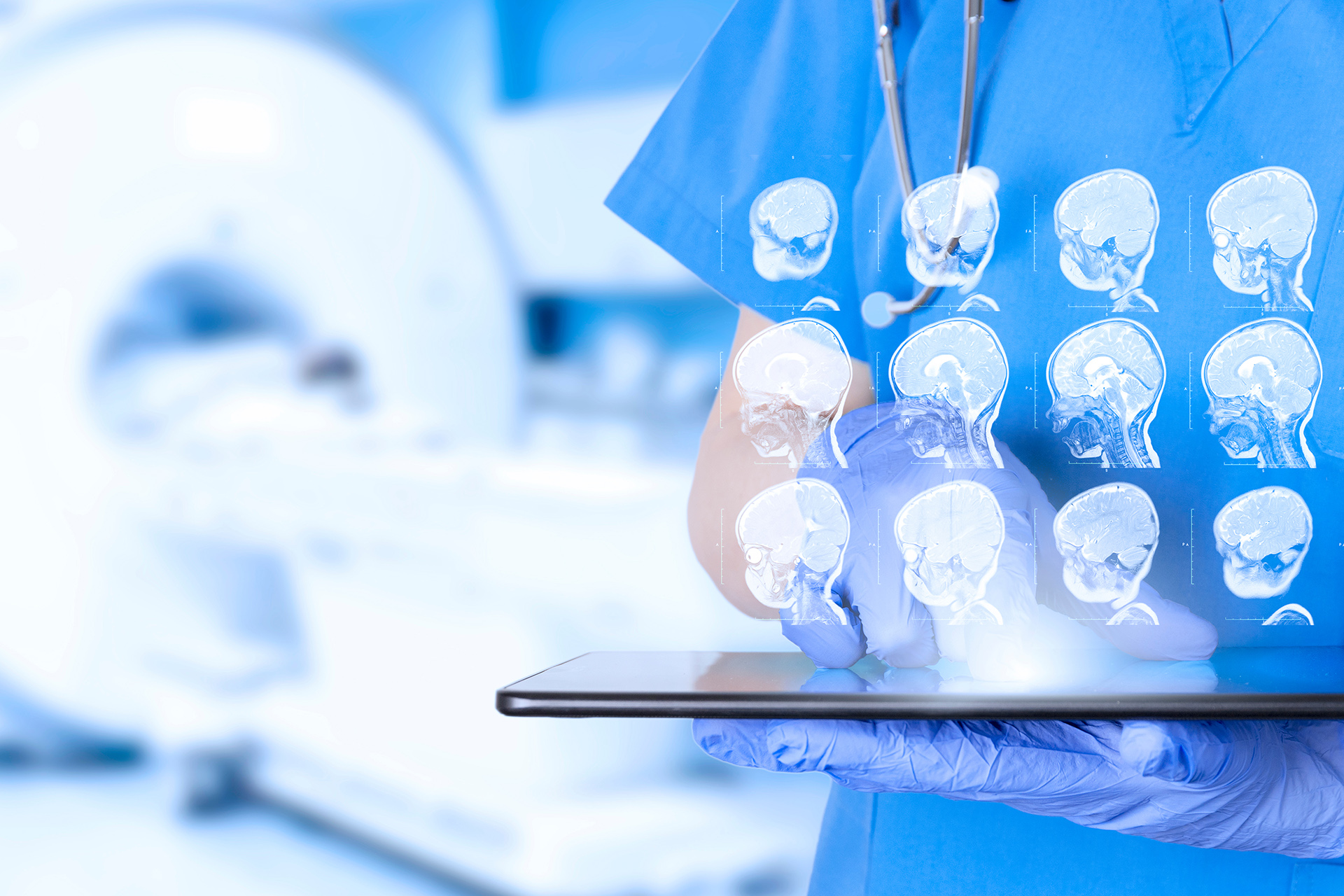 Detecting Pediatric Brain Cancer Recurrence: A Crucial Journey