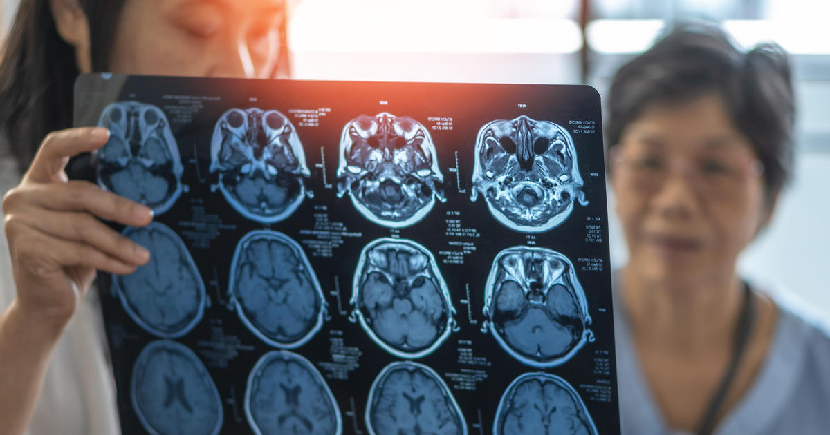 Brain cancer awareness: Understanding the signs, risks and treatments