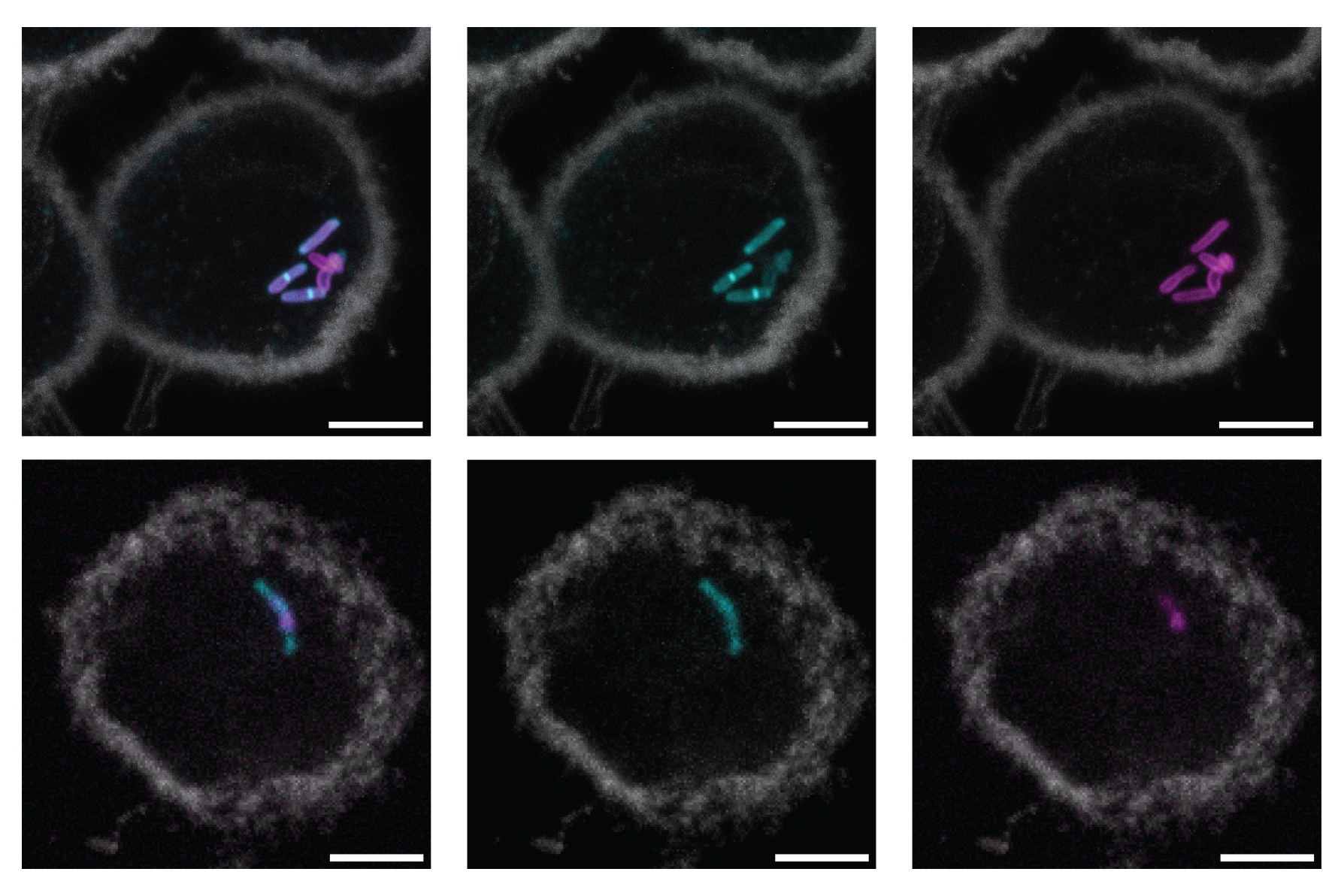 Revolutionary Molecular Marker Promises Speedier, Easier Detection of Tuberculosis
