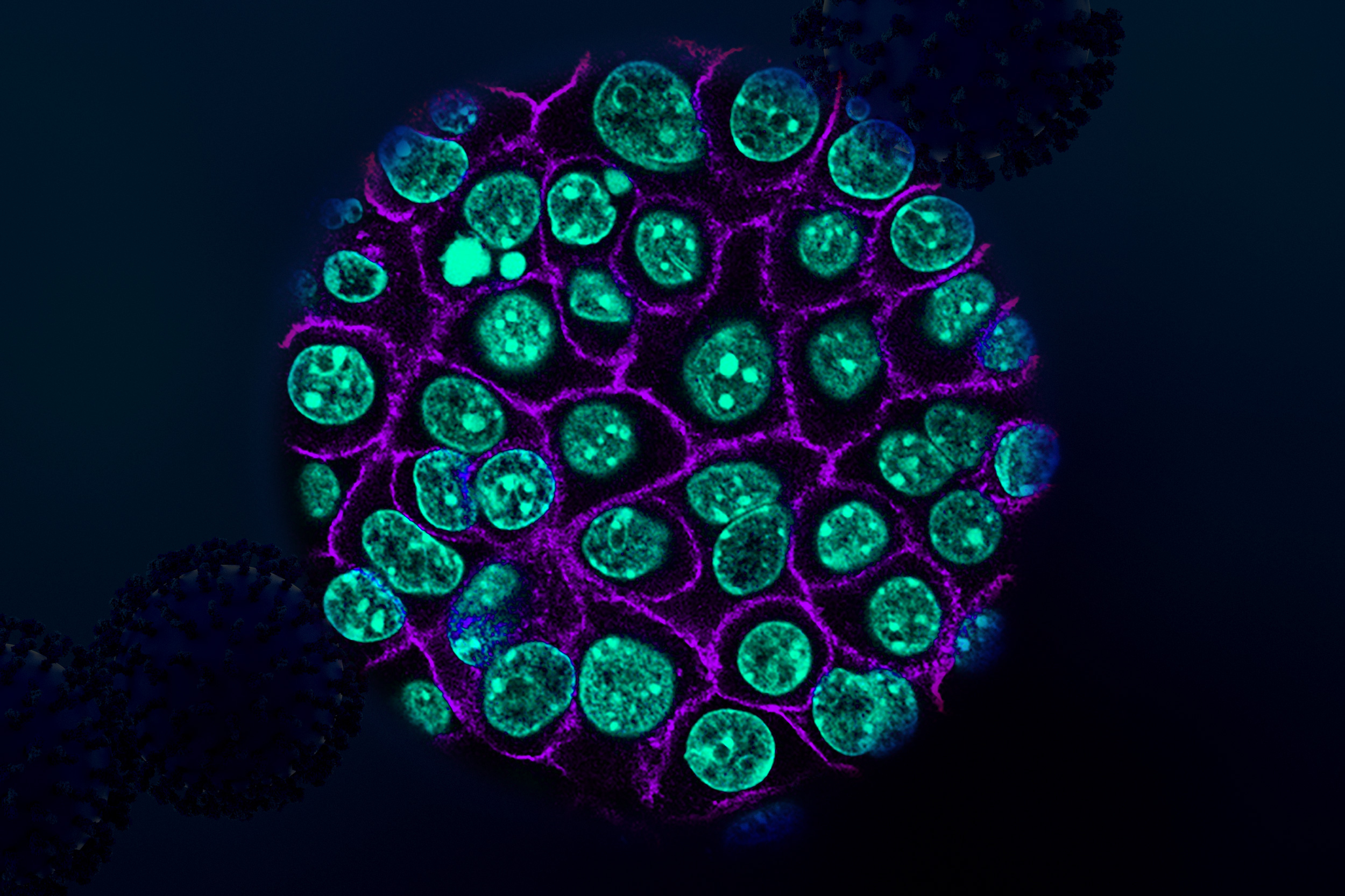 Breakthrough Discoveries: Targeted Avenues for Pancreatic Cancer Treatments