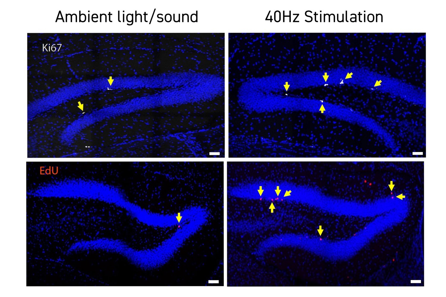 Stimulating Light and Sound at 40Hz Enhances Brain Function and Connectivity in Down Syndrome Mice