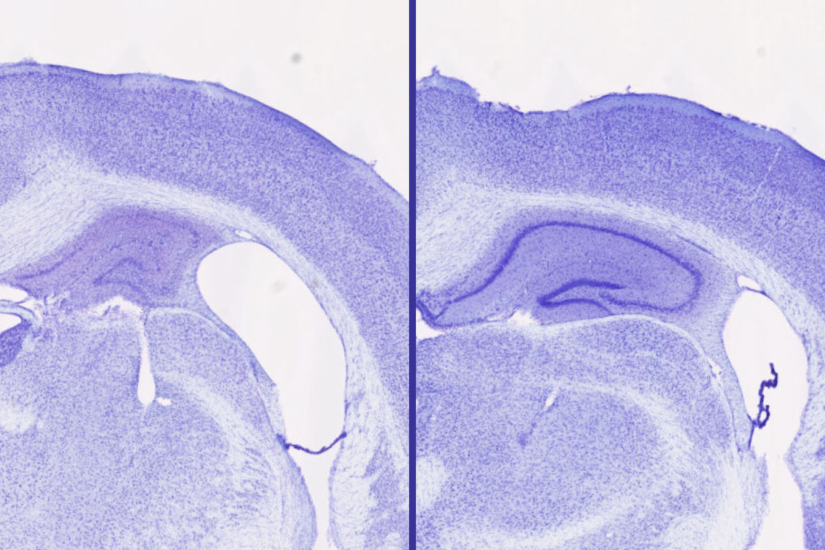 Sleep Enhancer Prevents Neurodegeneration in Mice