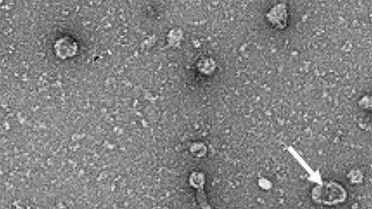 Revolutionary Nanoparticle Tool Emerges in Battle Against Cardiovascular and Kidney Disorders