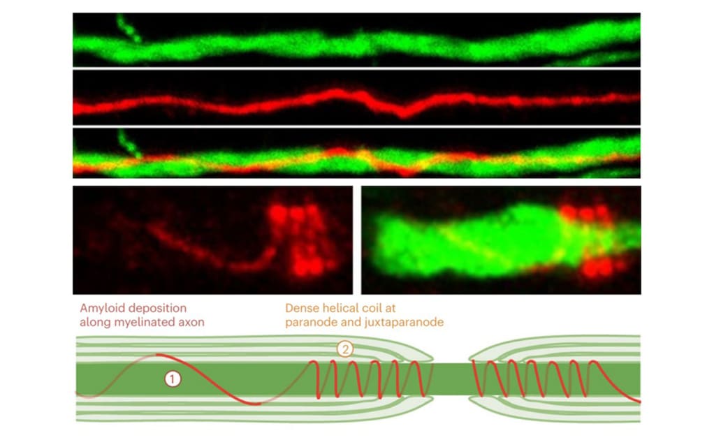 Exploring Myelin Sheath: A Key to Unraveling Alzheimer’s Disease