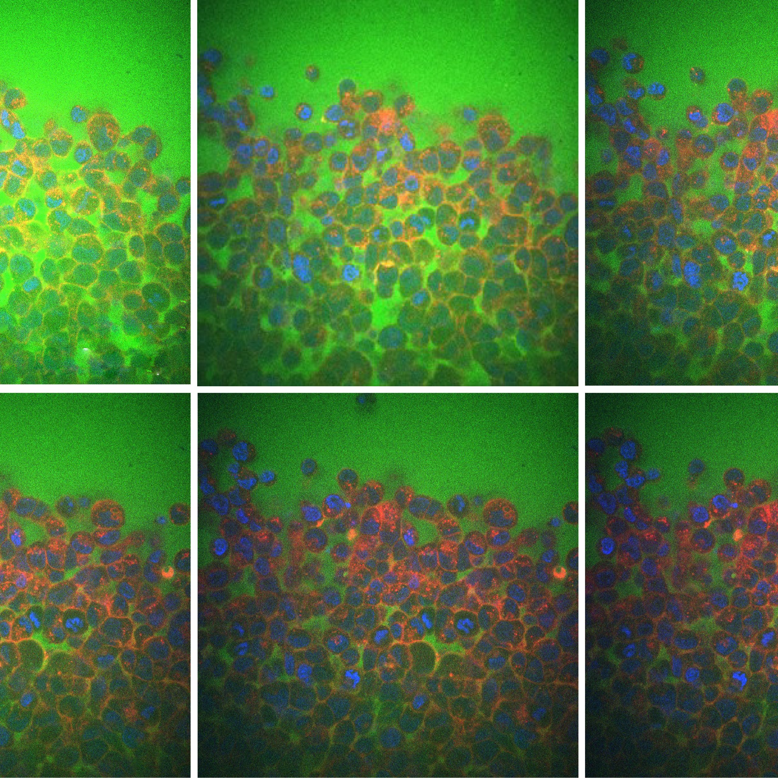 mit-engineers-uncover-a-surprising-reason-why-tissues-are-flexible-or-rigid