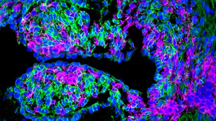 Zebrafish’s Genetic Blueprint Unlocks Secrets to Organ Regeneration