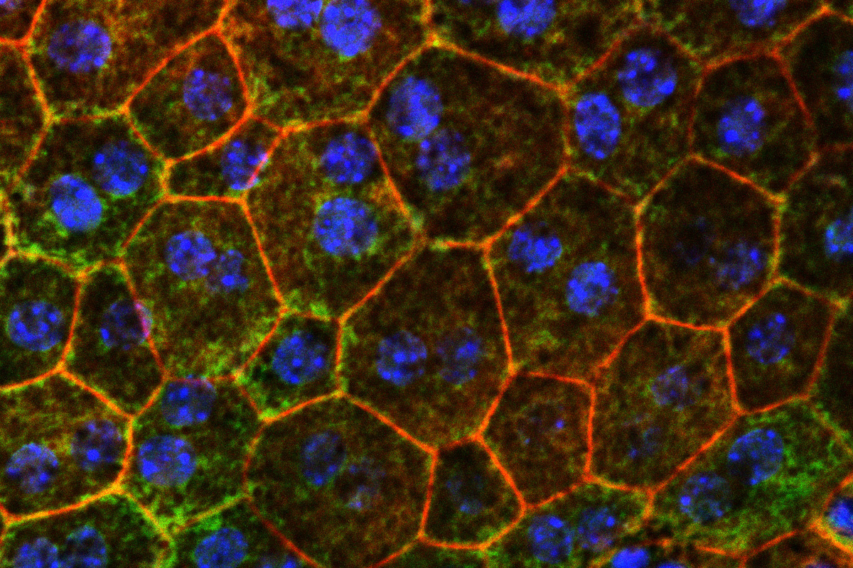 Breakthrough Strategy Unveiled to Combat Age-Related Macular Degeneration