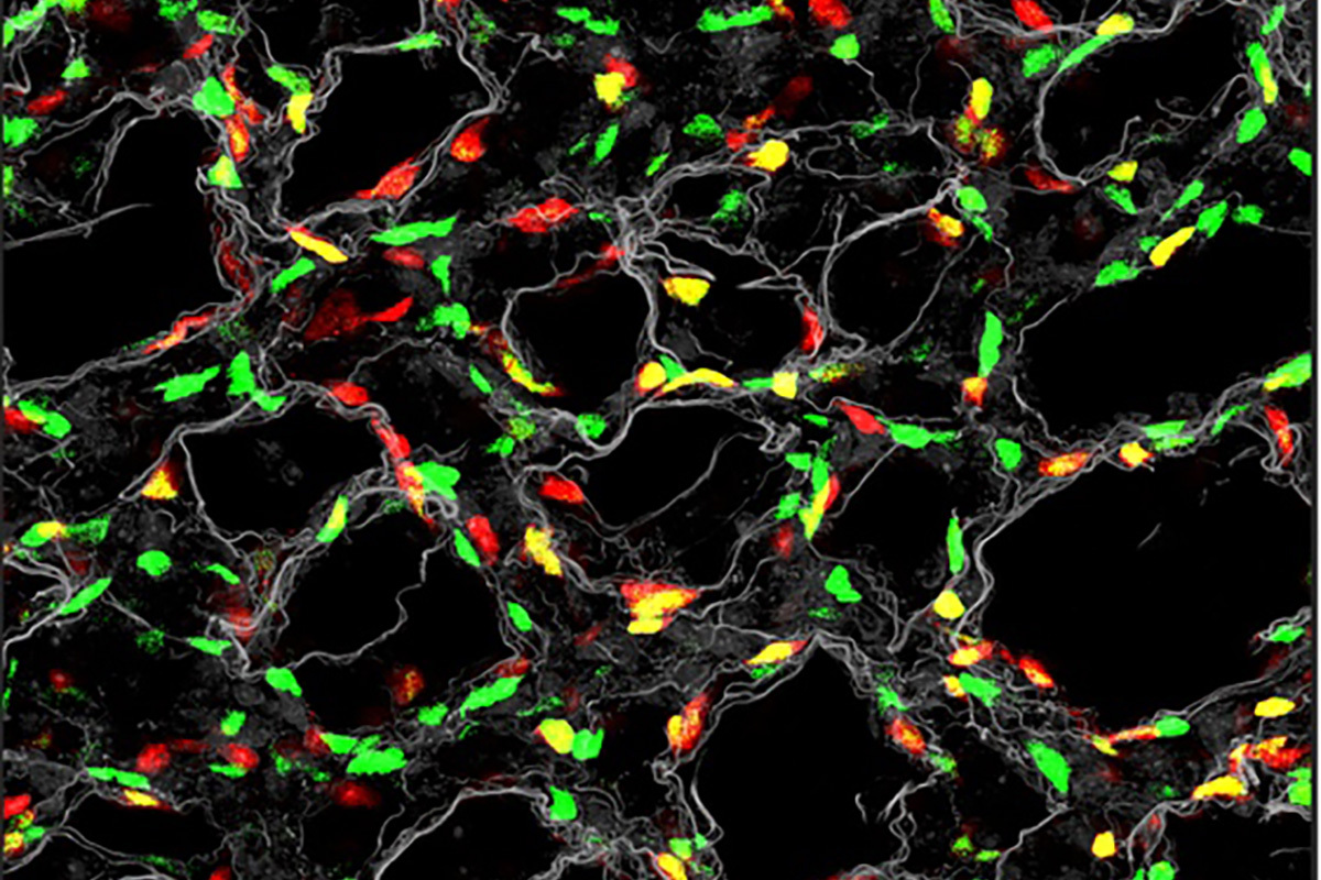 Ornitz Secures NIH Funding for Lung Development Research