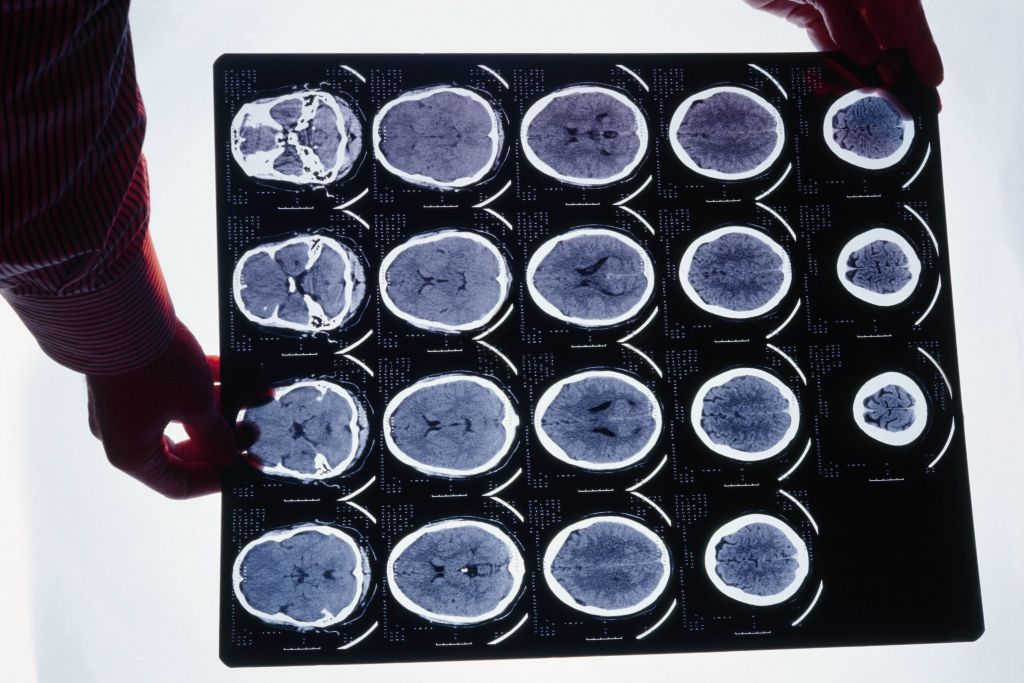 Revolutionary AI Tool Transforms How Patients Decode Their Radiology Reports