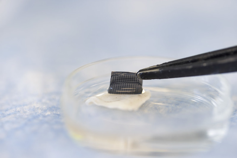 Revolutionary Skin Patch Test for Melanoma Detection at Home