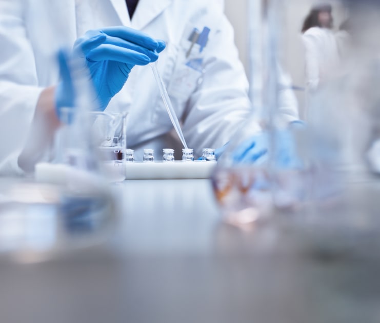 Cholesterol’s Surprising Influence on Fibrosis in Metabolic Liver Disease: A New Study Unveiled