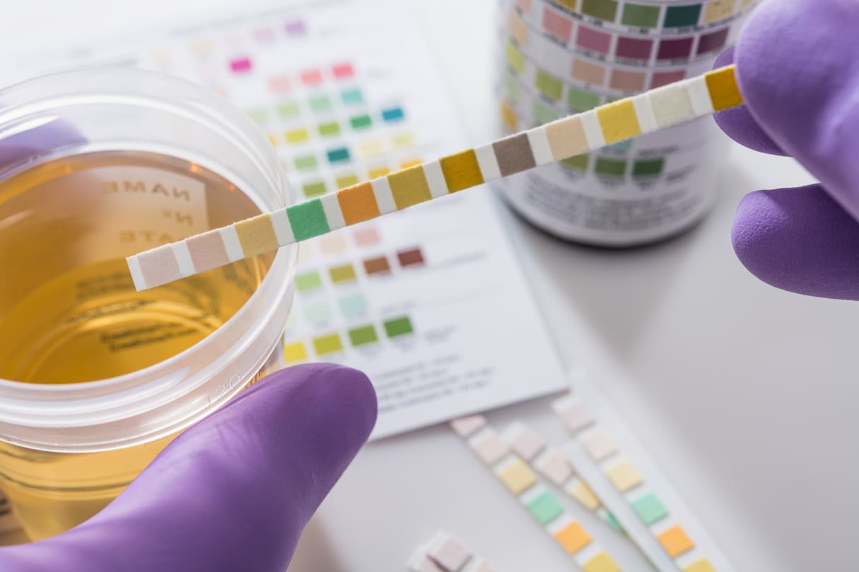 Essential Tests for Early Detection of Kidney Health Issues