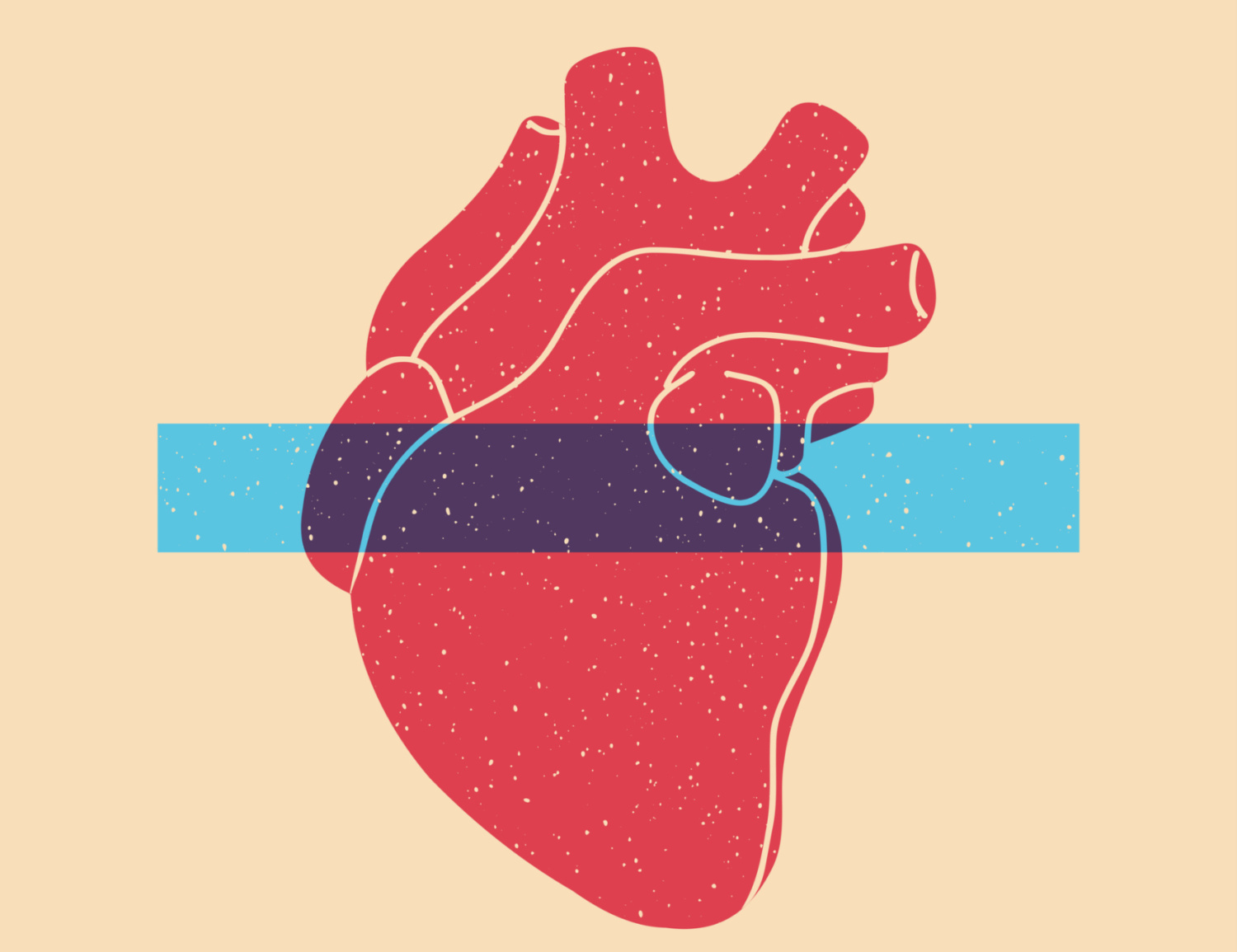 Navigating the Shift: The Rise of Chronic Heart Disease Amid Declining Heart Attack Mortality