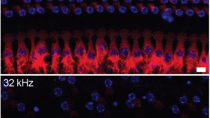 novel-approaches-for-protecting-the-inner-ear-from-hearing-loss