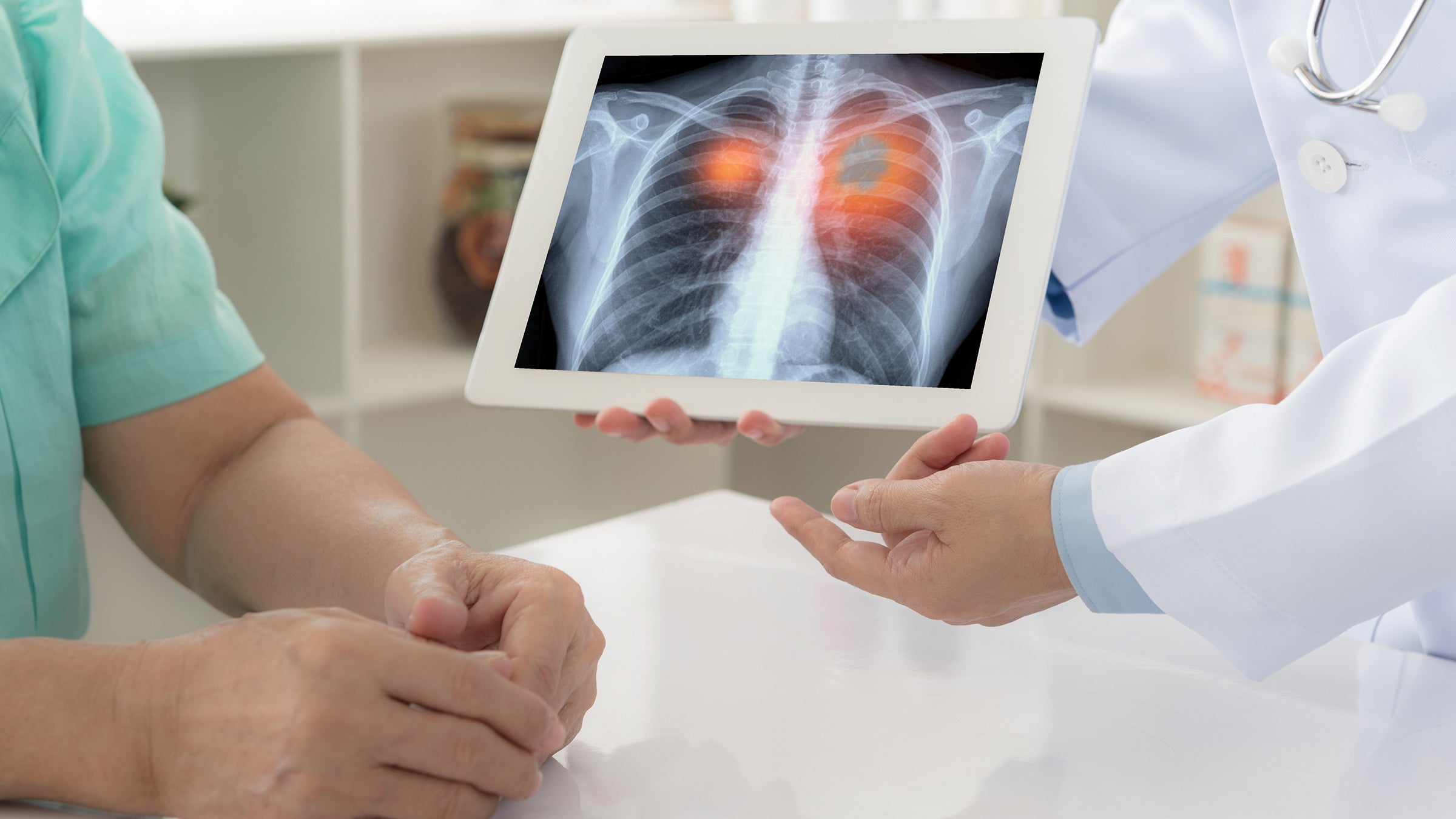 common-medication-for-lung-cancer-symptoms-found-to-limit-effectiveness-of-immunotherapies
