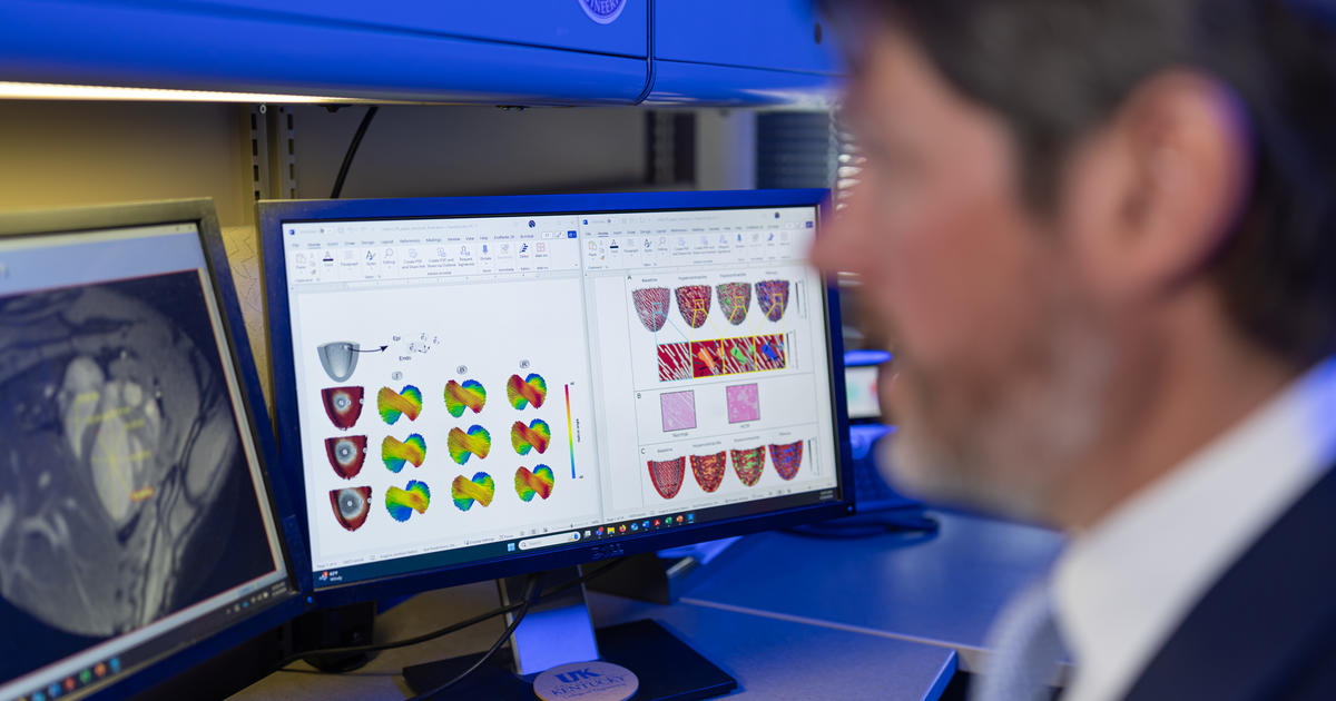UK engineering researcher leads NSF‑funded initiative to model heart fibrosis with machine learning