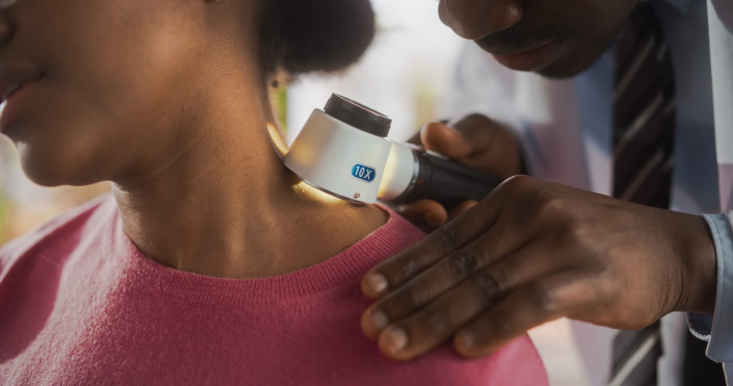Melanoma: Three Essential Insights You Should Know