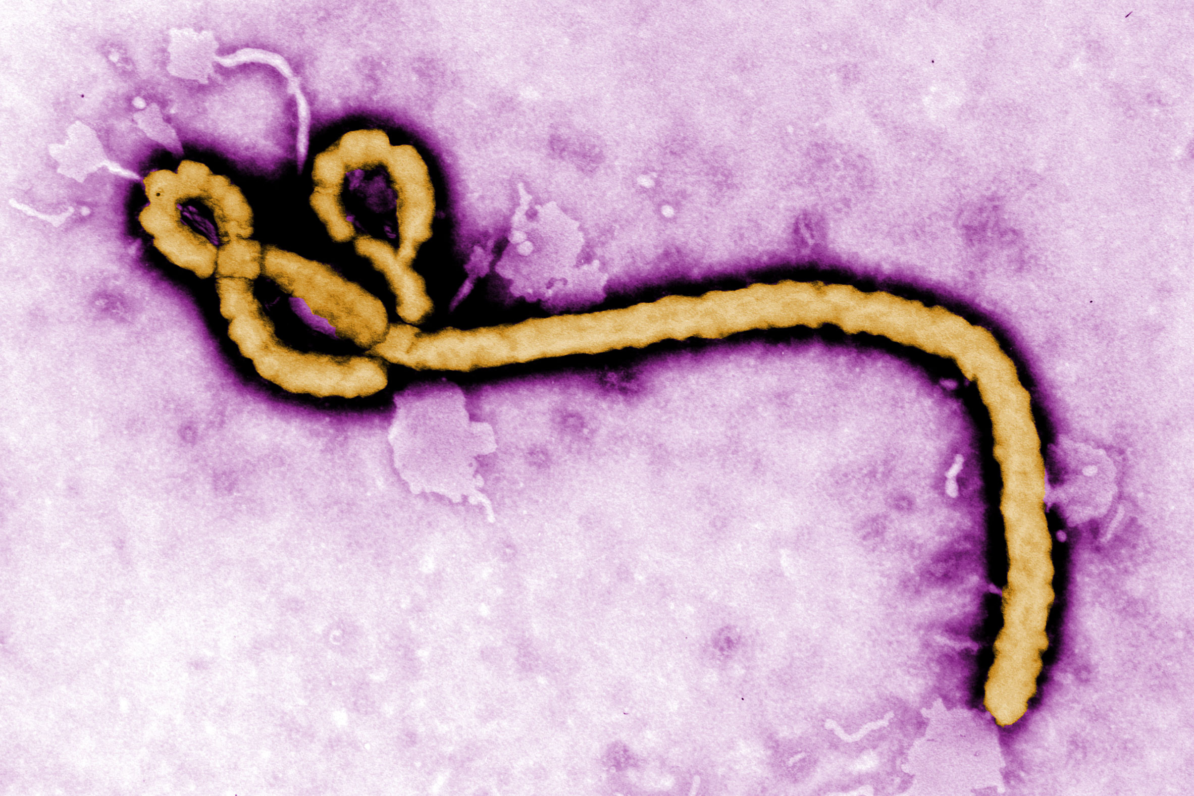 Innovative Optical Pooled CRISPR Screening Uncovers New Drug Targets for Ebola Treatment