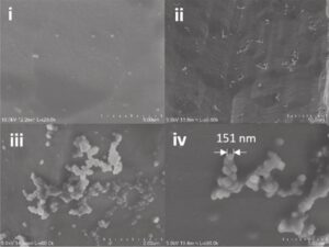 Four panels of gray scanning electron microscope images labeled 1 to 4. 1: A few sparse spherical exosomes on a light gray background. 2: Tens of clusters of exosome spheres on the microneedle teeth. 3: Close view of the clustered spheres form a chain on the needle. 4: A closer view of the clustered spheres points to a single exosome with the width labeled 151 nanometers.