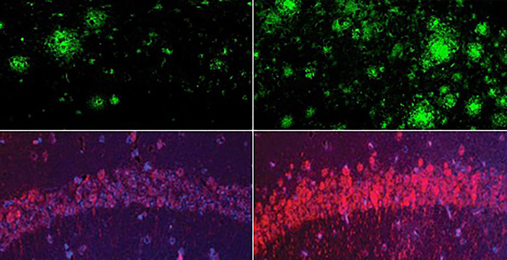 Could Lithium Hold the Key to Understanding and Treating Alzheimer’s?