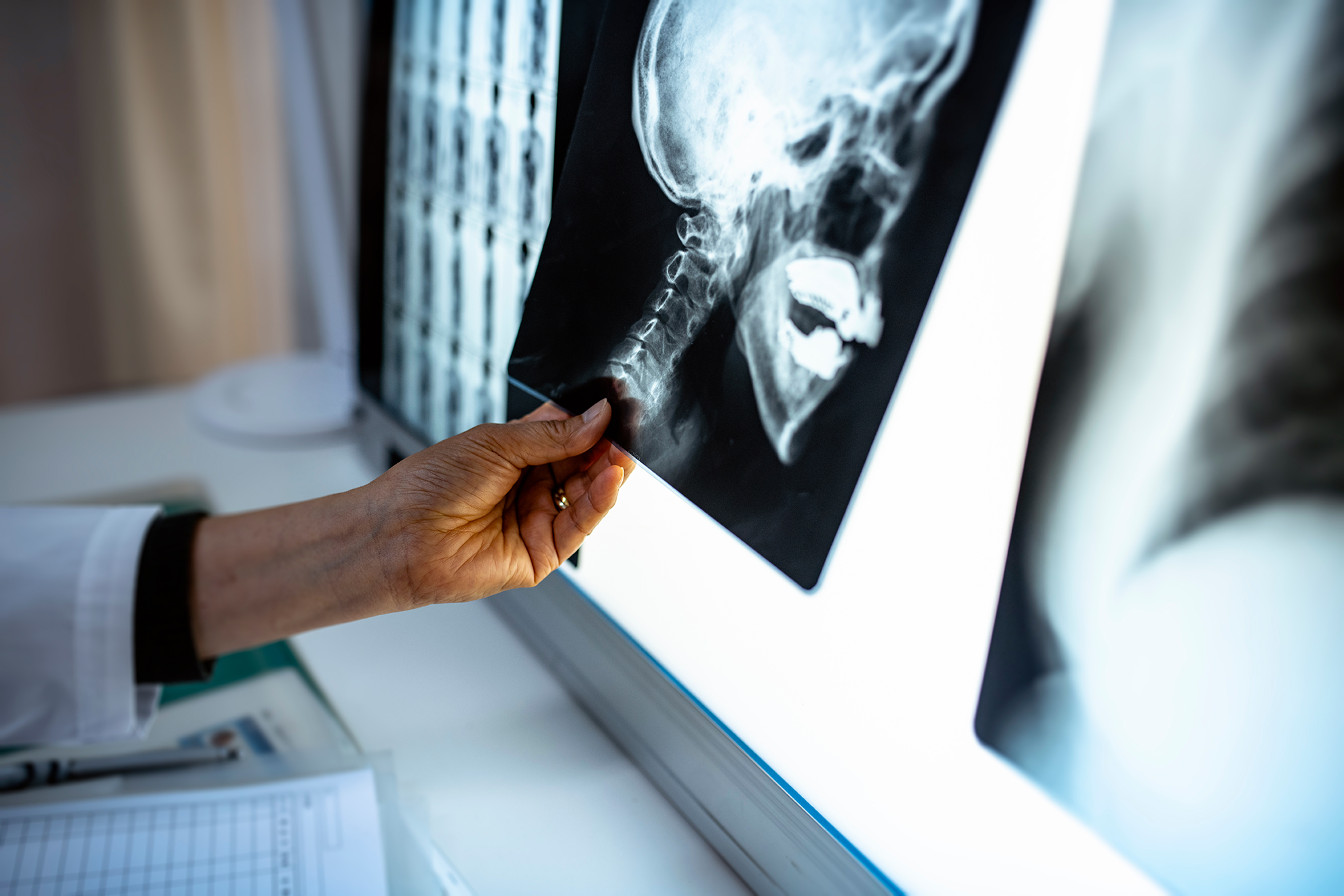 Setback in Promising Research for Fibrous Dysplasia Patients