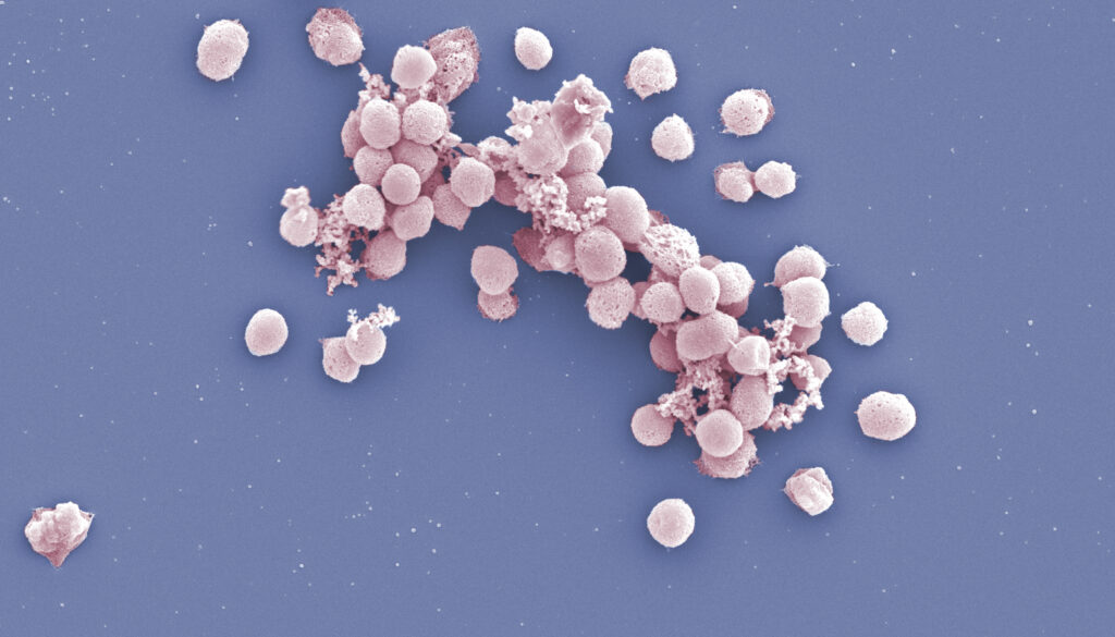 Microbial Innovations: Unlocking the Secrets of Methane Emissions