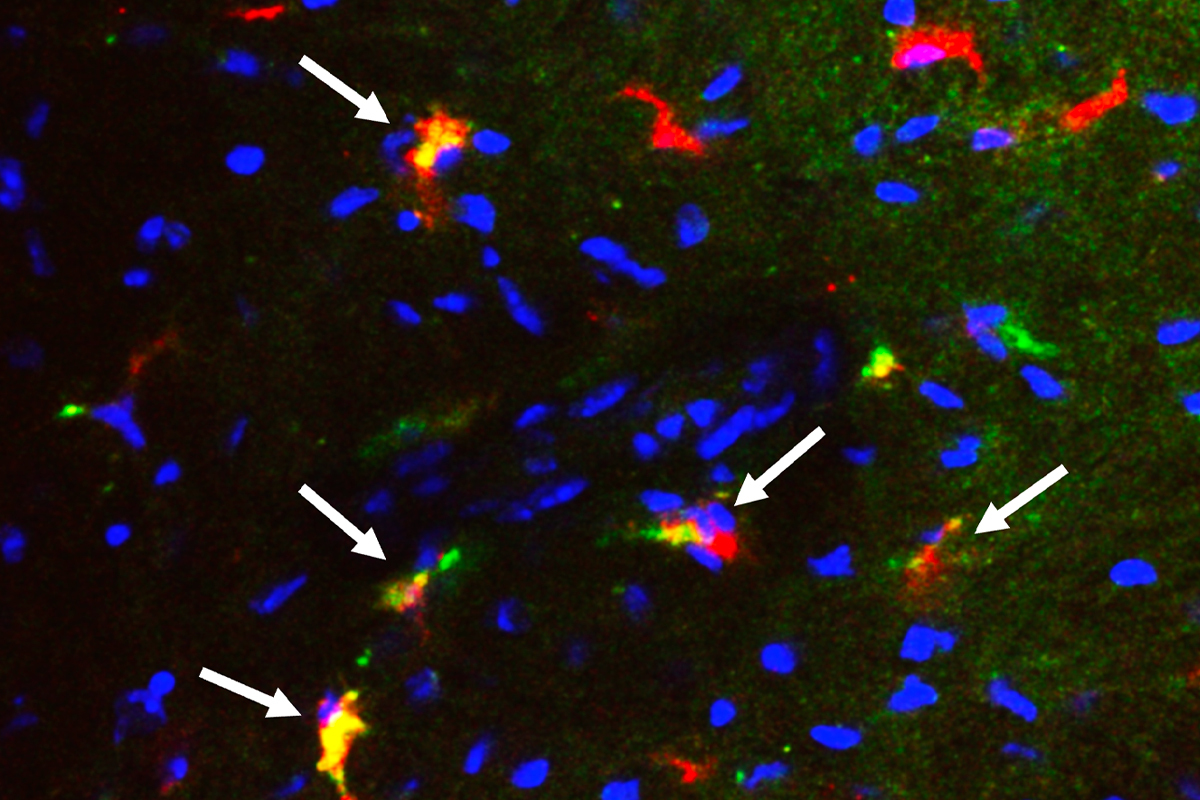 Spleen Cells Uncover Unexpected Function Following Heart Attack