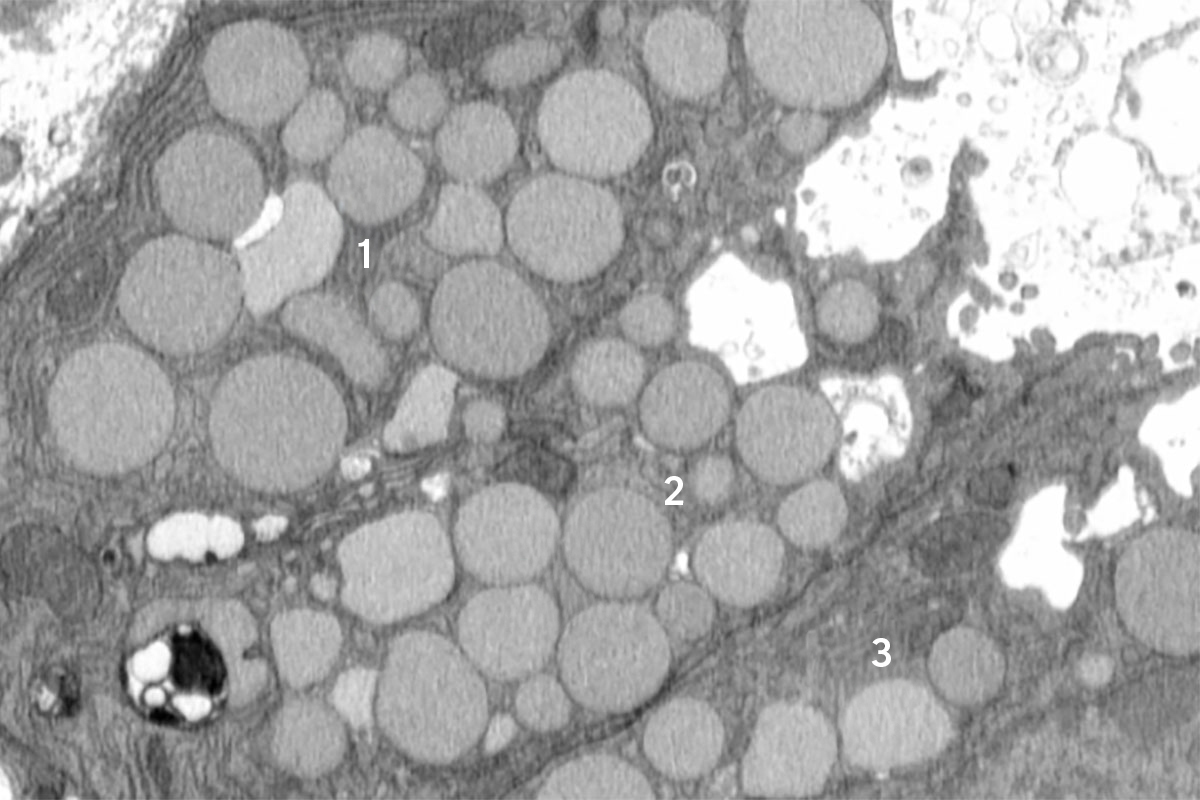 cells-‘vomit’-waste-to-promote-healing,-mouse-study-reveals
