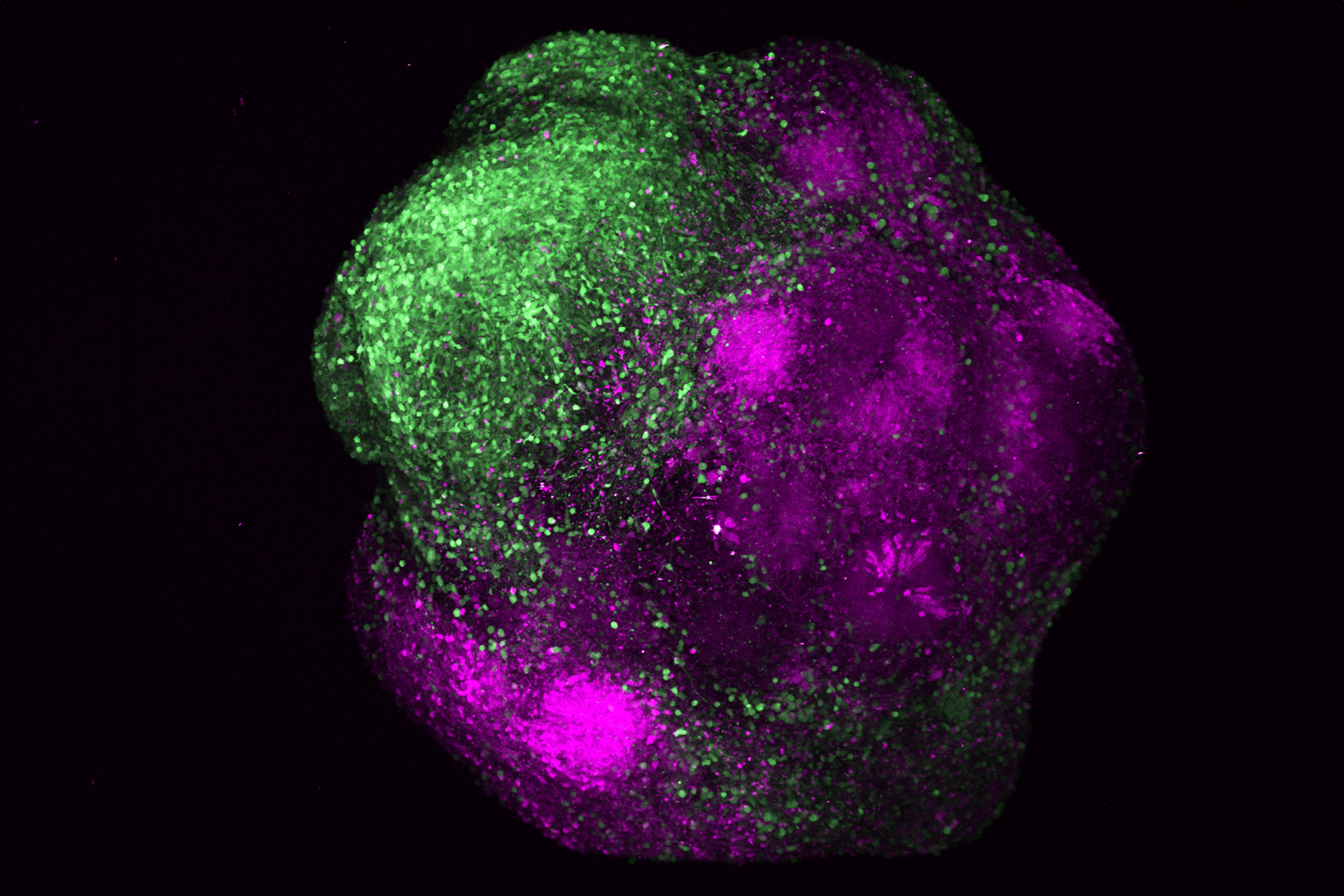 Human brain organoid displaying the integration of excitatory (magenta) and inhibitory neurons (green) of the cerebral cortex.