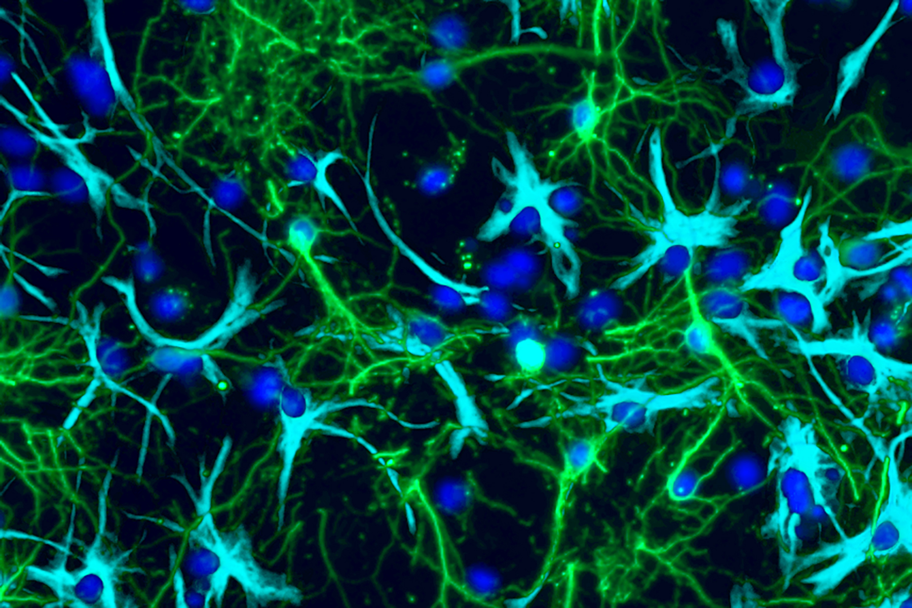 study-sheds-light-on-how-pediatric-brain-tumors grow
