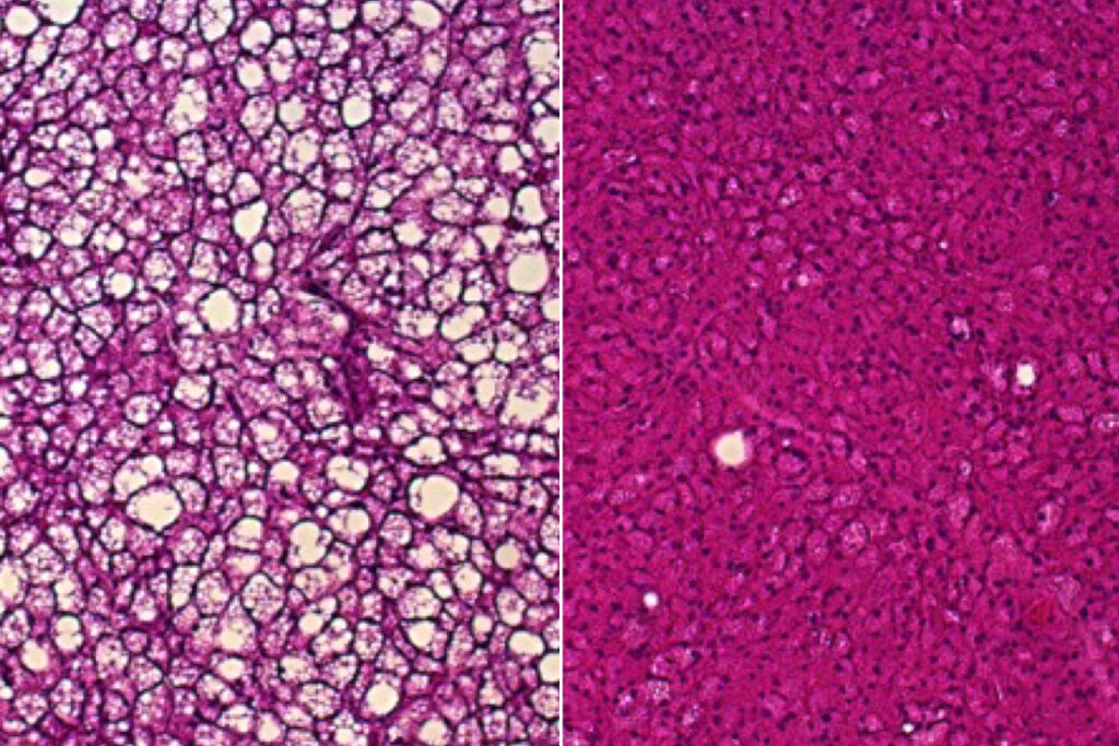Innovative Approach to Boost Brown Fat: A New Frontier in Caloric Burn and Obesity Control in Mice