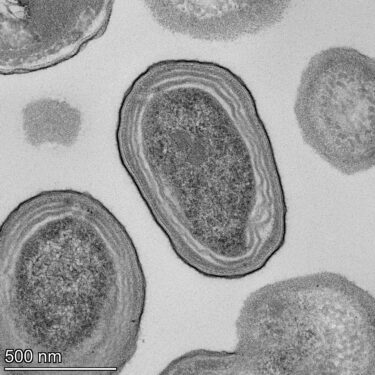 Circular forms observed under a microscope. Each form represents a single Prochlorococcus cell.