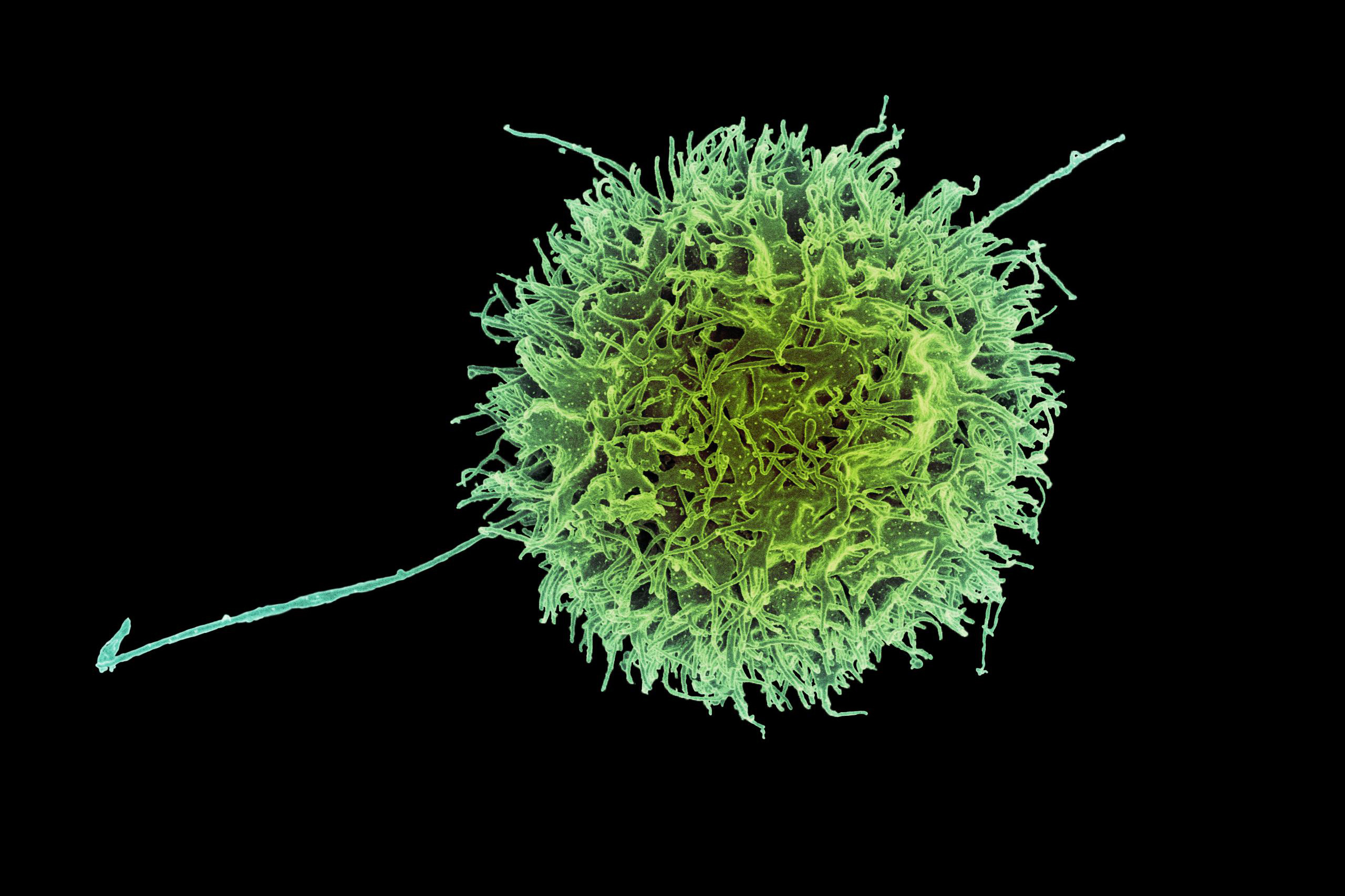 Revolutionary “Natural Killer” Cells: A New Frontier in Cancer Combat