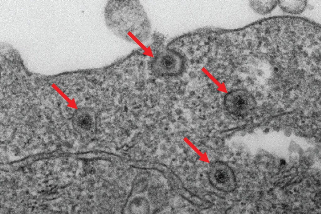 Breakthrough Discovery: Battling a Lethal Infection Head-On